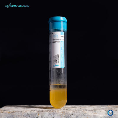 Allevii la provetta di dolore PRP 20ml ACD-A con il GEL per il trattamento di OA