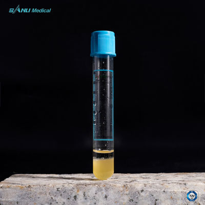 Metropolitana di Rich Plasma PRP della piastrina del gel del citrato di sodio 3,2% con il gel
